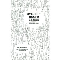 Afbeelding van Over het hoofd gezien