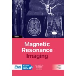 Afbeelding van Magnetic  resonance imaging